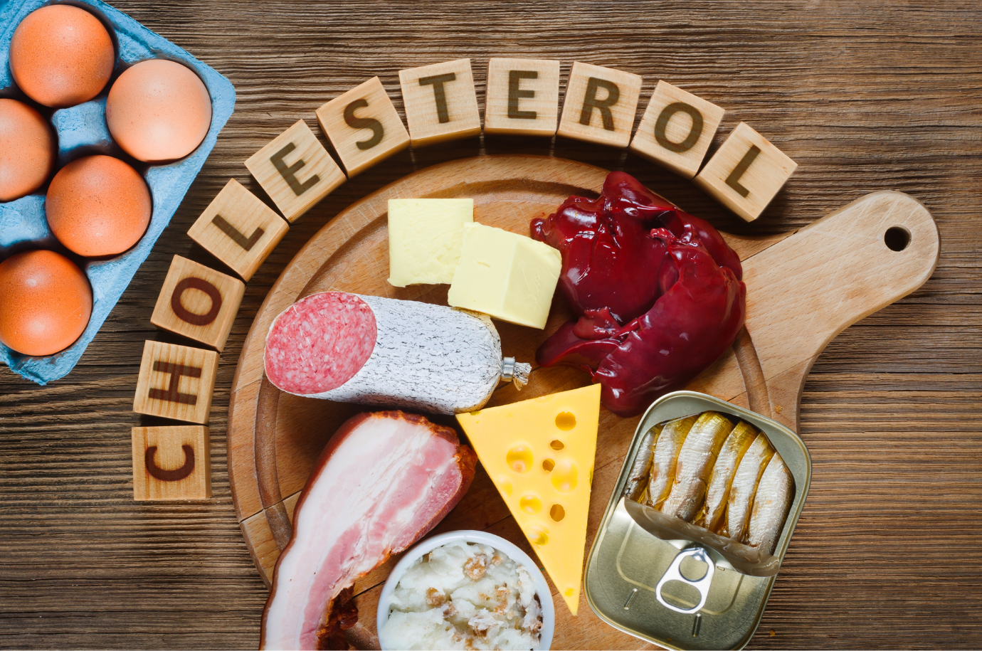 High Cholesterol Treatment