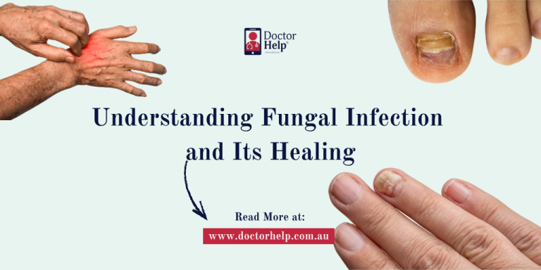 Understanding Fungal Infection and Its Healing