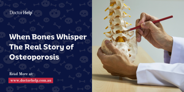 When Bones Whisper The Real Story of Osteoporosis
