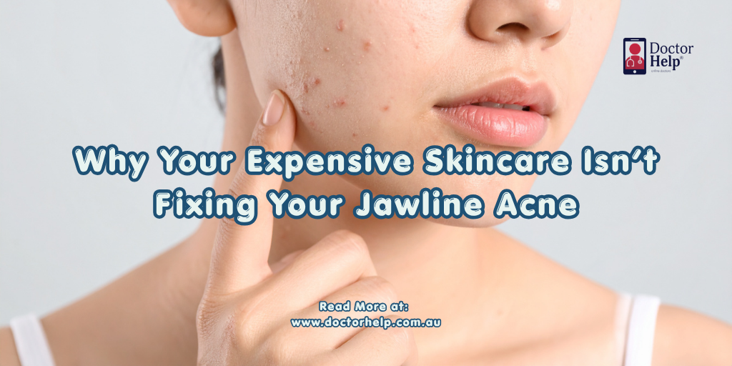 Why Your Expensive Skincare Isn’t Fixing Your Jawline Acne