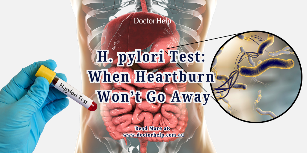 H. pylori Test When Heartburn Won’t Go Away